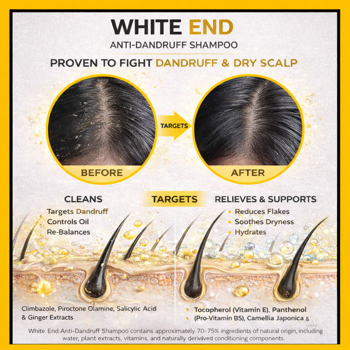 White End Anti-Dandruff Shampoo - 30ml Sample Sachet