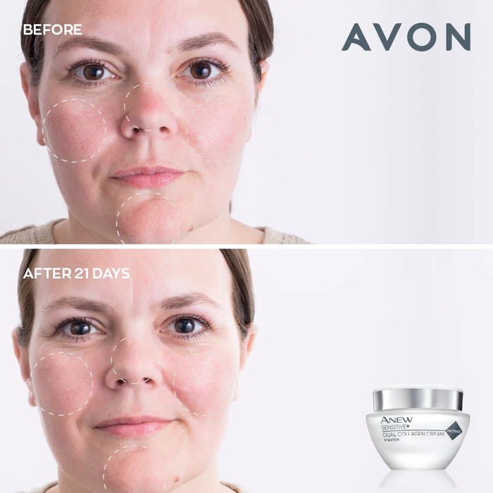 Avon Anew Sensitive+ Dual Collagen Collection Set