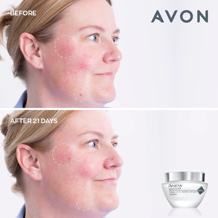 Avon Anew Sensitive+ Dual Collagen Collection Set
