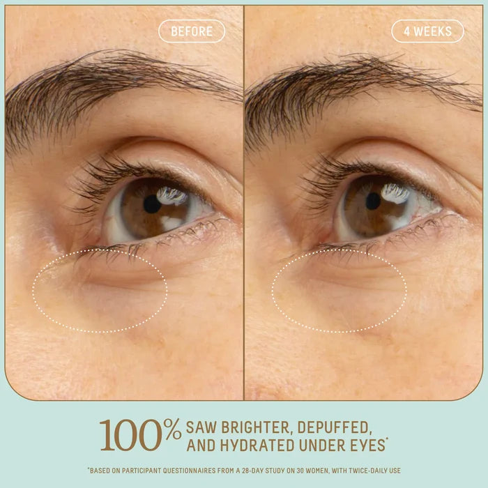 Biossance  5% Niacinamide Brightening Eye Serum with Vitamin C + Squalane NWOB