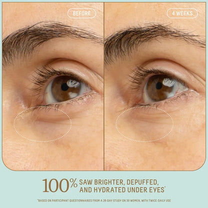 Biossance  5% Niacinamide Brightening Eye Serum with Vitamin C + Squalane NWOB