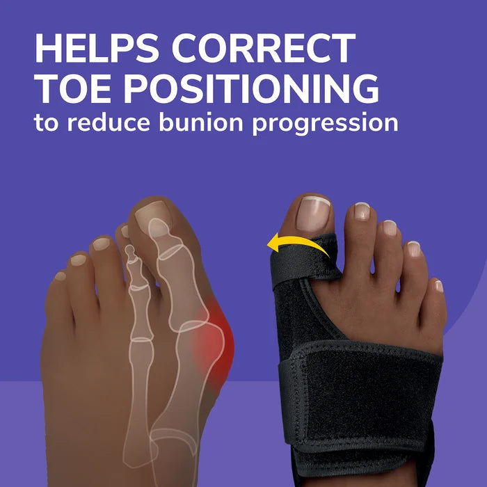 Black bunion toe corrector splint with strap on foot, helping toe positioning.