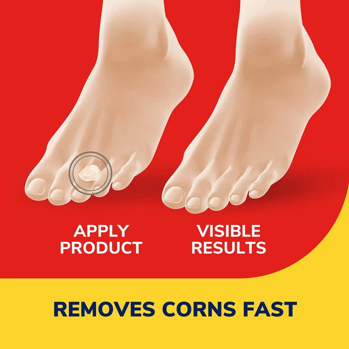 Corn removers promotional graphic with two bare feet