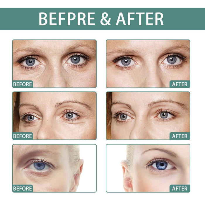 EELHOE Jasmine Eye Cream – Anti-Wrinkle Eye Care for Dark Spots & Hydration EELHOE COSMETICS