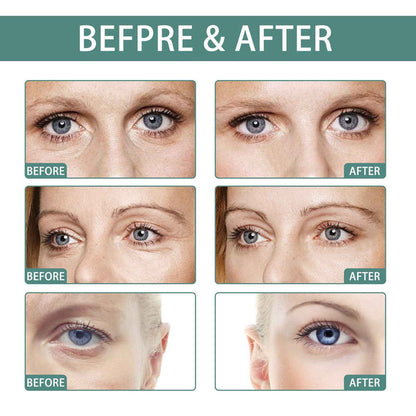 EELHOE Jasmine Eye Cream – Anti-Wrinkle Eye Care for Dark Spots & Hydration EELHOE COSMETICS