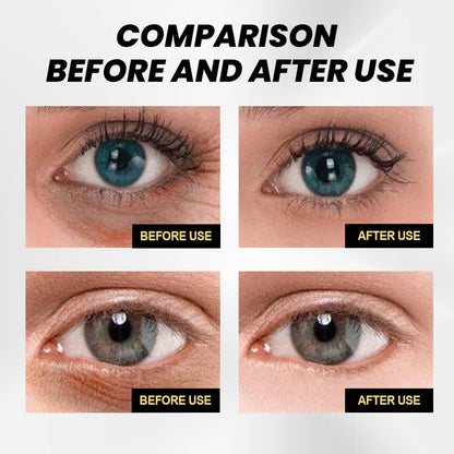 EELHOE Jasmine Eye Cream – Anti-Wrinkle Eye Care for Dark Spots & Hydration EELHOE COSMETICS