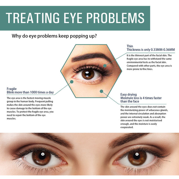 EELHOE Jasmine Eye Cream – Anti-Wrinkle Eye Care for Dark Spots & Hydration EELHOE COSMETICS