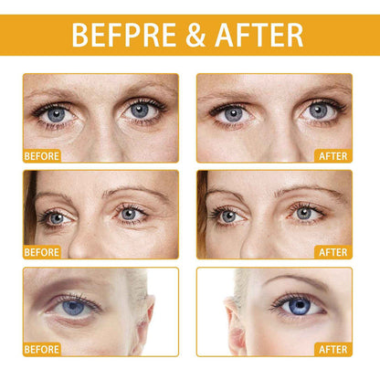 EELHOE Rice Puree Eye Cream 20g – Eye Cream for Dark Circles, Eye Bags & Wrinkles EELHOE COSMETICS