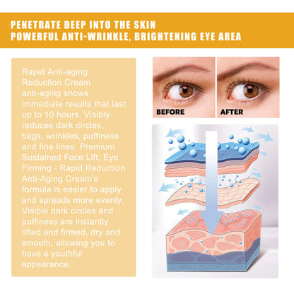 EELHOE Rice Puree Eye Cream 20g – Eye Cream for Dark Circles, Eye Bags & Wrinkles EELHOE COSMETICS
