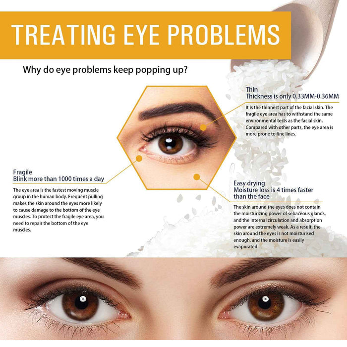 EELHOE Rice Puree Eye Cream 20g – Eye Cream for Dark Circles, Eye Bags & Wrinkles EELHOE COSMETICS