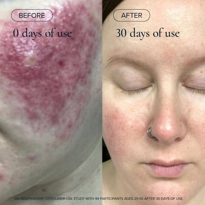 MARA-Evening Primrose + Green Tea Algae Retinol Face Oil-Skincare-MARA-ARO-30_6-The Detox Market |