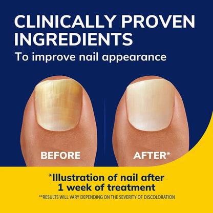 Fungal nail revitalizer before and after toenail appearance panel
