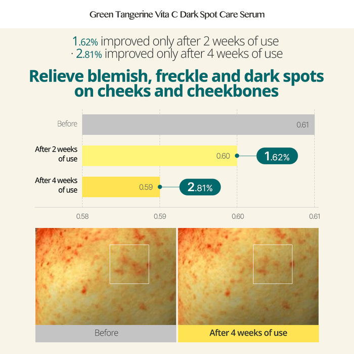 [GOODAL] Green Tangerine Vita C Dark Spot Serum 40ml - CLUB CLIO