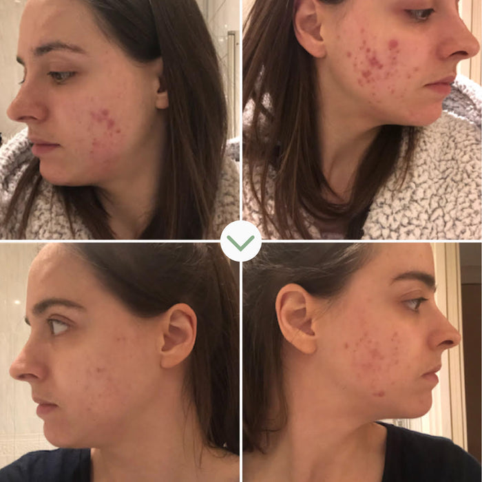 Pai Skincare-Instant Kalmer-Skincare-5060139721677_5-The Detox Market |