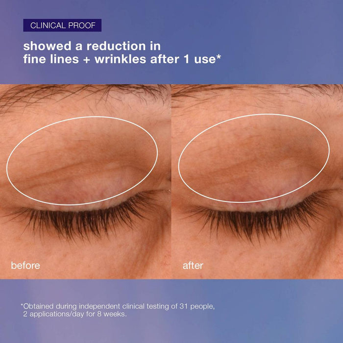 phyto nature lifting eye cream