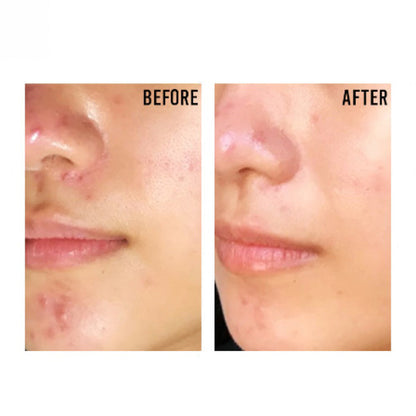 PURITO Centella Unscented Recovery Cream 50 ml