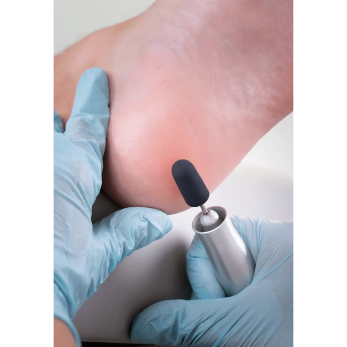 Round abrasive caps x10 1302 - Diamond - Medium grain - Abrasion of corns, calluses and hyperkeratoses - 5 mm Ruck
