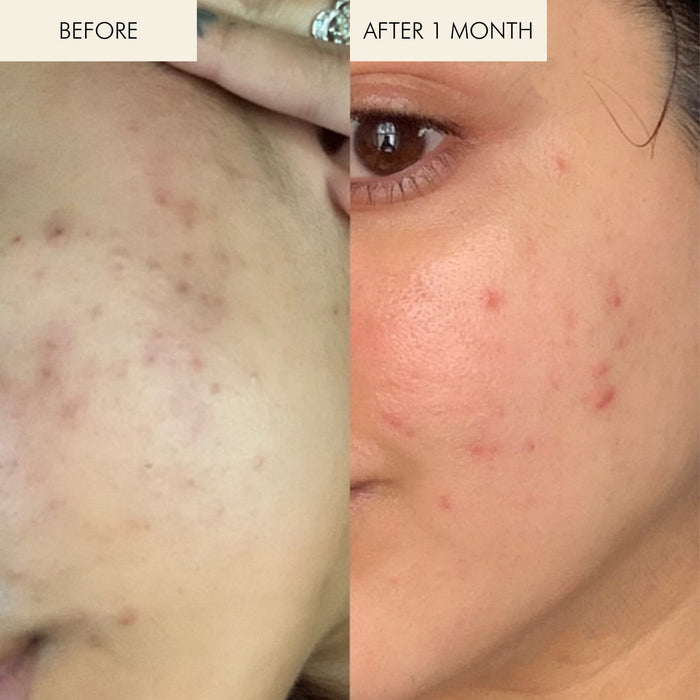 MARA-Sea Vitamin C Serum-Skincare-MARA-SVCS-30_4-The Detox Market |