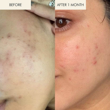 MARA-Sea Vitamin C Serum-Skincare-MARA-SVCS-30_4-The Detox Market |