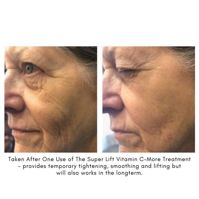Maya chia-The Super Lift Vitamin C-More Treatment-