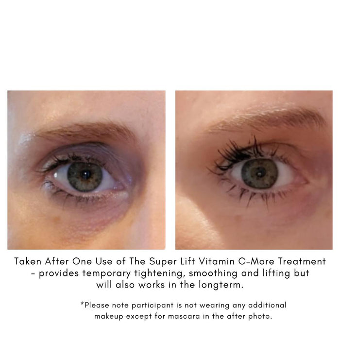 Maya chia-The Super Lift Vitamin C-More Treatment-